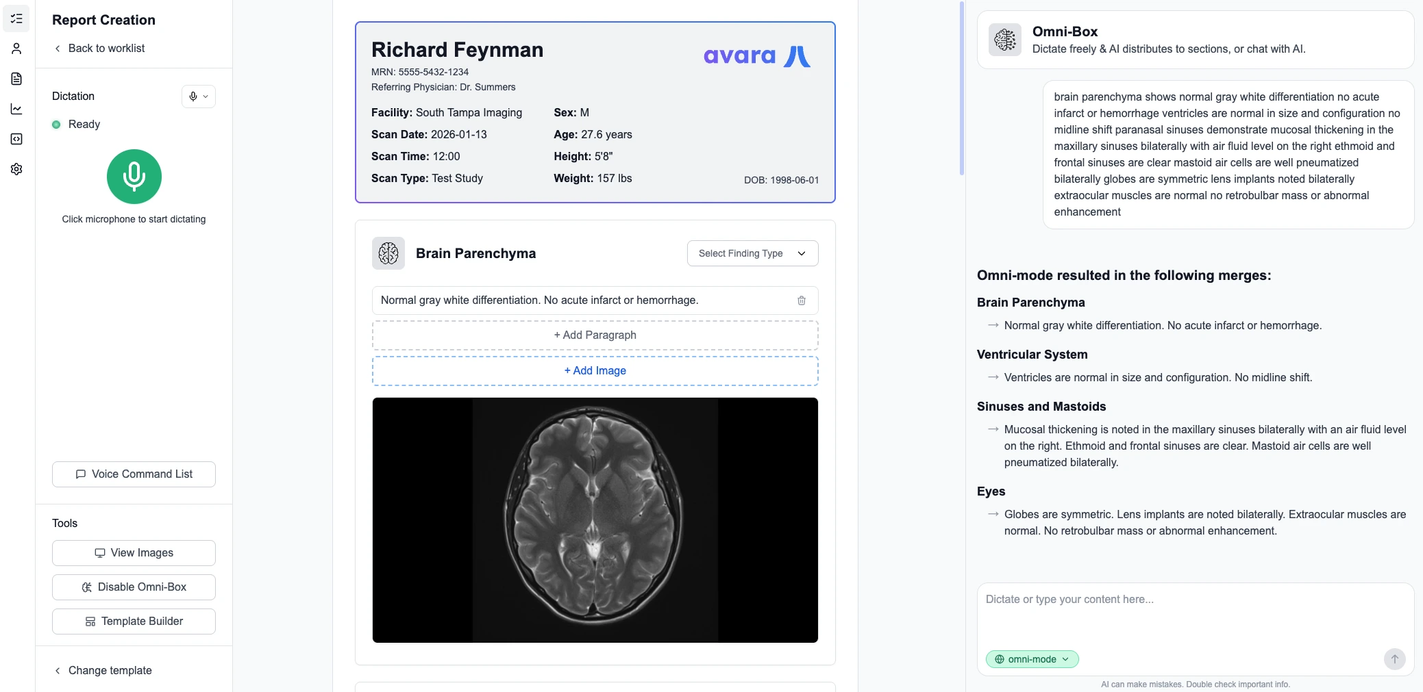 AutoScribe Interface