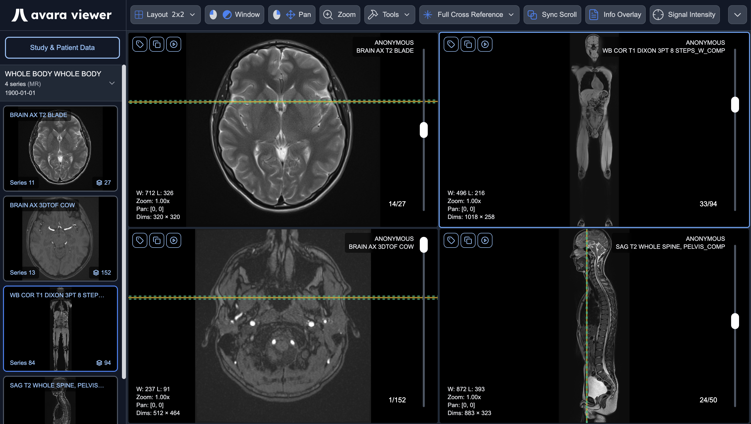 Avara Viewer Interface